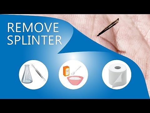 How to Remove Splinter | 3 Methods