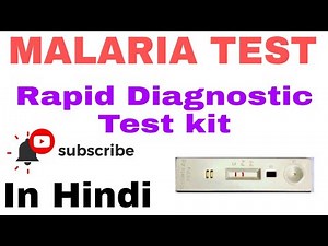 Rapid Diagnostic Test for Malaria