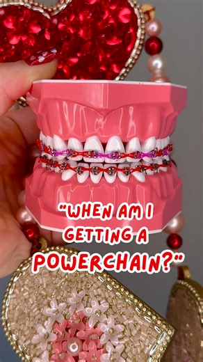 What are BRACES POWERCHAINS? 🦷 . .. ... If you're curious why you have single ties or powerchains, make sure to ask your orthodontist! There are many different reasons we might use one or the other! . .. ... #braces #bracescolors #bracestips #teeth #foryoupage