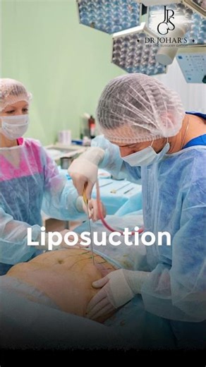 Liposuction vs Weight Loss | Biggest Fat Loss Myth Explained by Dr Ruchika