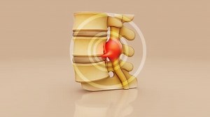 Herniated Disc Nerve Compression in Human Spine Model 3D Animation