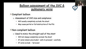 Superior Sinus Venosus ASDs: TOE Assessment and Guidance of Percutaneous Treatment