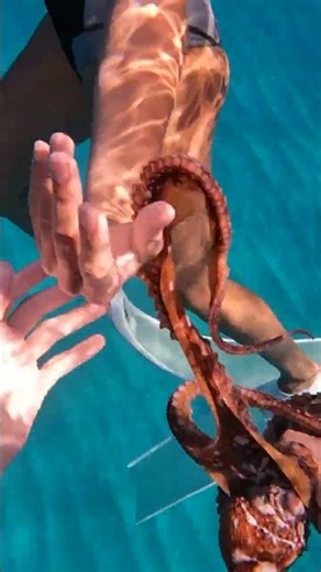 the octopus was stuck to her leg and had to be carefully remvoed