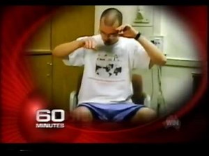 Deep Brain Stimulation (DBS) Parkinsons Australia