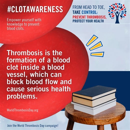 Let's go back to the basics! What is thrombosis 🤔? Thrombosis happens when a blood clot forms inside a blood vessel. This clot can slow down or block blood flow and when blood can’t move the way it should, -> it can lead to serious health problems. Knowing the signs, understanding your risk, and getting care quickly can save lives. If something doesn’t feel right, trust your instincts and seek medical help. Visit worldthrombosisday.org to learn more #WorldThrombosisDay #BloodClotAwareness #Know