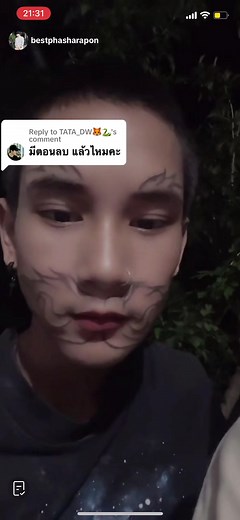 ลบรอยสักหน้ายักษ์: น้องภูหลังลบล่าสุด