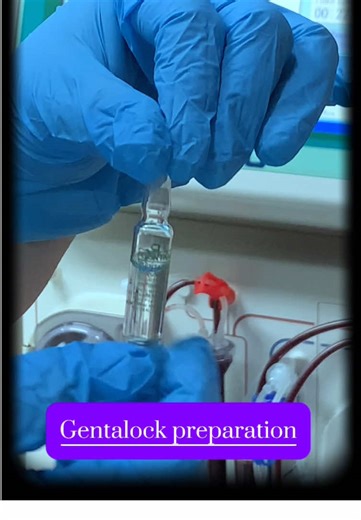 Locking Catheters with Gentamicin for Dialysis Care