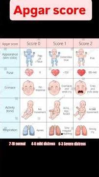 Apgar score |Neonatal 👶assessment |paediatric health nursing 🧑‍⚕️