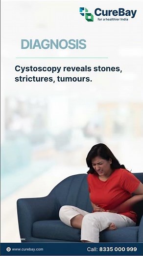 Cystoscopy Procedure Explained: What to Expect, Benefits & Preparation | CureBay #cystoscopy