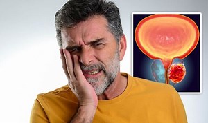 Prostate cancer: Dr Philippa Kaye discusses symptoms