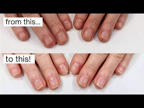 How did she stop biting & picking her nails? [week by week progress]