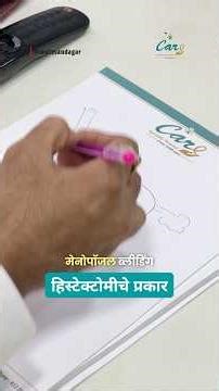 हिस्टेक्टोमीचे प्रकार | Radical Hysterectomy समजून घ्या | Dr. Mahesh Pawar