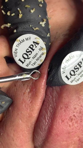 Chăm Sóc Dân Mũn: Effective Practices