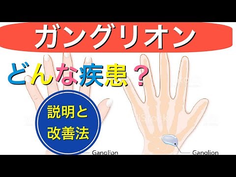 【ガングリオン】症状解説、治療方法、先ずは自分の症状を理解！