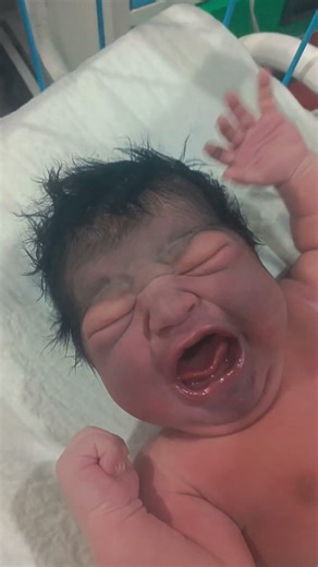 Newborn Baby Severe Cry ⚠️ | Warning Sign of Neonatal Seizure? | Emergency NICU Care