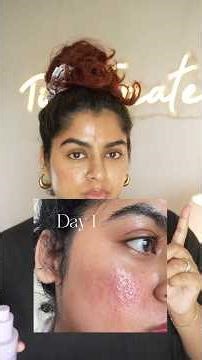 I USED EXPIRED PRODUCT MISTAKENLY