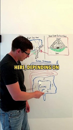 Colitis Facts YOU MUST KNOW!!!