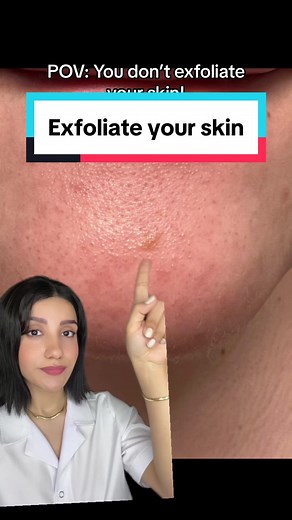 Effective Tips for Skin Exfoliation Routine