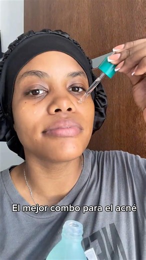 Ácido azelaico para acne, manchas y mejor textura de la piel ✨ #skincare