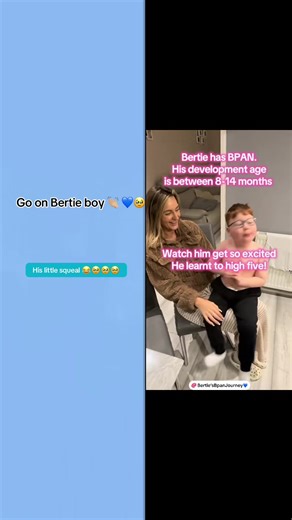 #duet with @Bertie’sBpanJourney💙 #fyp Key Characteristics in Boys (and Girls) Early Childhood (Stage 1): Infantile-onset seizures (epileptic encephalopathy). Severe developmental delays, especially speech. Ataxia (unsteady gait) and clumsiness. Autism-like features, repetitive hand movements (hand-flapping). Sleep problems. Later Life (Stage 2): Seizures often become less severe or stop. Progressive parkinsonism (slow movement, stiffness, balance issues). Worsening intellectual disability and n