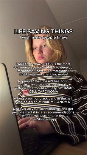 Did you know these things about skin cancer! #melanomaawareness #skincaretips #basalcellcarcinoma