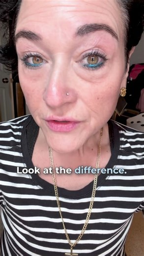 The transformation is unreal ✨ A tiny dab of Plexaderm Rapid Reduction Serum instantly smooths the appearance of under-eye bags and fine lines... the results speak for themselves 👁️💖 Fast, visible results that wow and last up to 10 hours 🙌 #Plexaderm #SkincareWin #GlowUp #ByeByeBags #RapidReductionSerum | Plexaderm Skincare