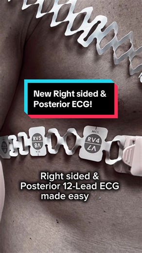 Mastering Right-Sided and Posterior ECG Techniques