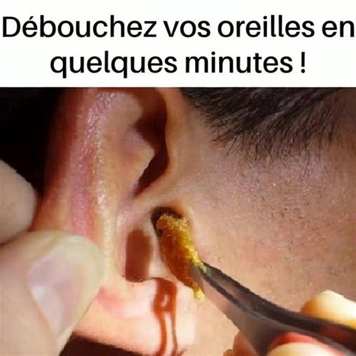 Oreille bouchée : causes et solutions efficaces (lien en commentaire) | Les Bons Moments