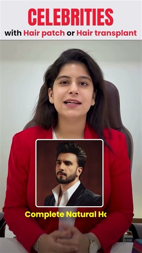 Celebrity Hair Transplant & Hair Patch Solutions | Natural Full-Density Results at Clion Care