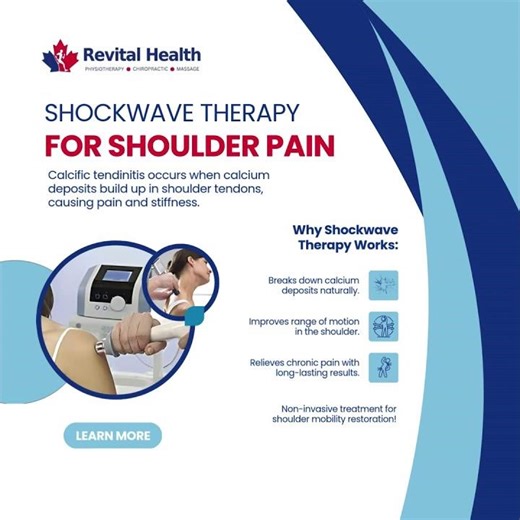 Shockwave Therapy for Calcific Shoulder Tendinitis