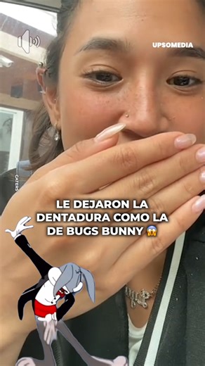 Se rompió un diente y solicitó una dentadura de conejo 🐰 | Upsocl Video