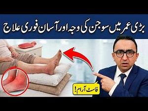 Over 50: Why Your Feet and Ankles Swell? And How to Fix It at Home?