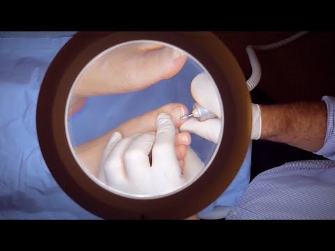 Career Guide: Want to be a Podiatrist?