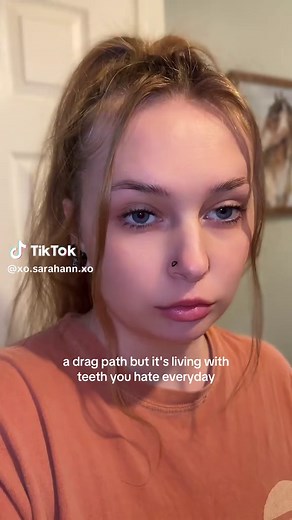 Living with Bad Teeth: A Relatable Journey