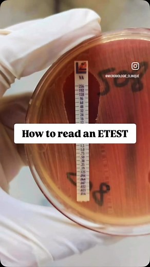 How to read etest #microbiology #microbiologist #microbiologylab #explorepage #microbe #bacteriology #science #molecularbiology #kesfet #virology #phd #phdstudent #phdjourney #microbiologia | Medical Microbiologist