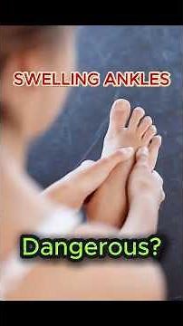 Why Are My Ankles Swelling? (Leg Edema Causes & Fixes)