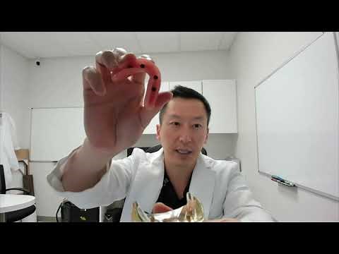 How does a snap on denture work?