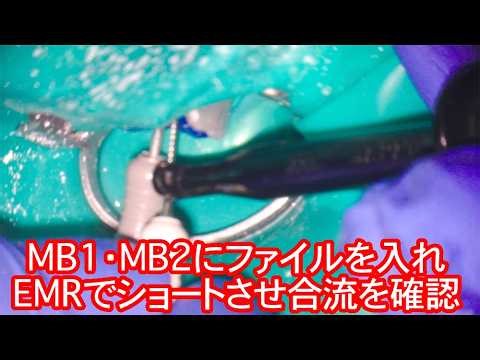 MB1・MB2にファイルを入れEMRでショートさせ合流を確認したケース