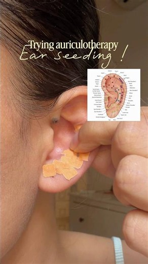 Ear seeding.Promotes circulation, regulates the nervous system & supports lymphatic drainage.