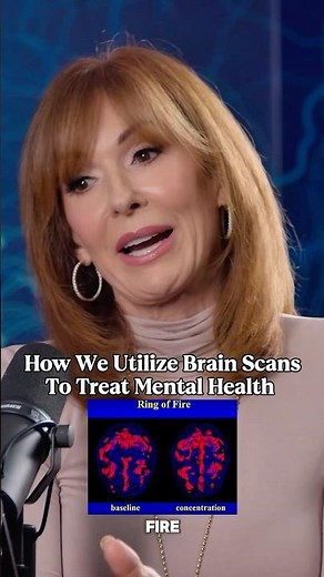 SPECT Scans Can Treat Mental Health