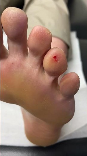 Seed Corn Toe Balance Challenge Tutorial Beginner Tips and Tricks #SeedCornBalance #ToeBalance