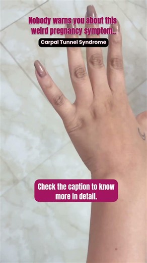 Carpal Tunnel Syndrome in pregnancy #carpaltunnelsyndrome #pregnancytips #checkdescription
