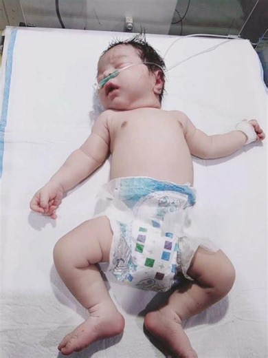 critical condition newborn baby in NICU