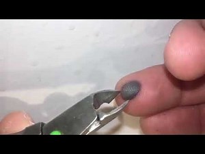 How to remove a blood blister
