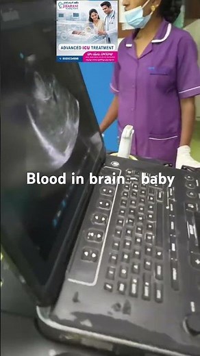 : Understanding Neonatal Intracranial Hemorrhage: A Case Study- blood in baby brain