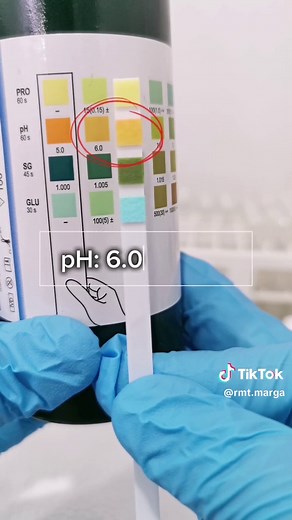 Cara Membaca Urine Dipstick dengan Hasil Normal