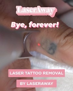 268K views · 11 reactions | Ready to ditch your unwanted ink? Laser tattoo removal by LaserAway produces dramatic results with multiple sessions and works on all skin types! | LaserAway | Facebook