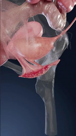 Qu'est-ce que la vulvite et comment cela impacte-t-il la santé des femmes ? Explication en 3D