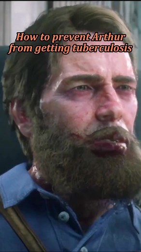 Red Dead Redemption 2 Tuberculosis Cure: How to Get Rid of Arthur's Illness