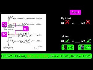 Blink Reflex Test. Practice 3